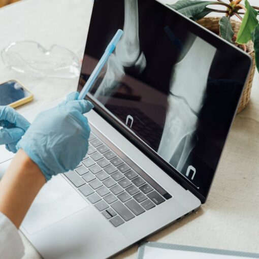 doctor looking at the bones on a laptop screen