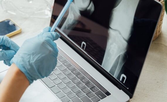 doctor looking at the bones on a laptop screen